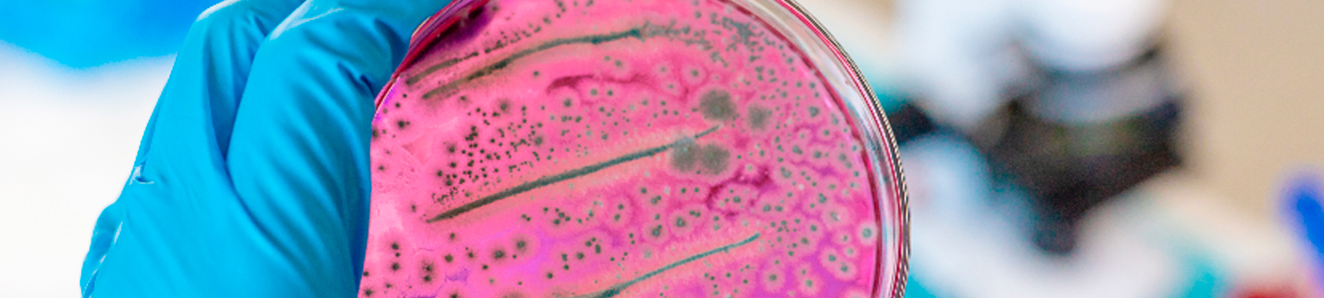 mikrobiologi